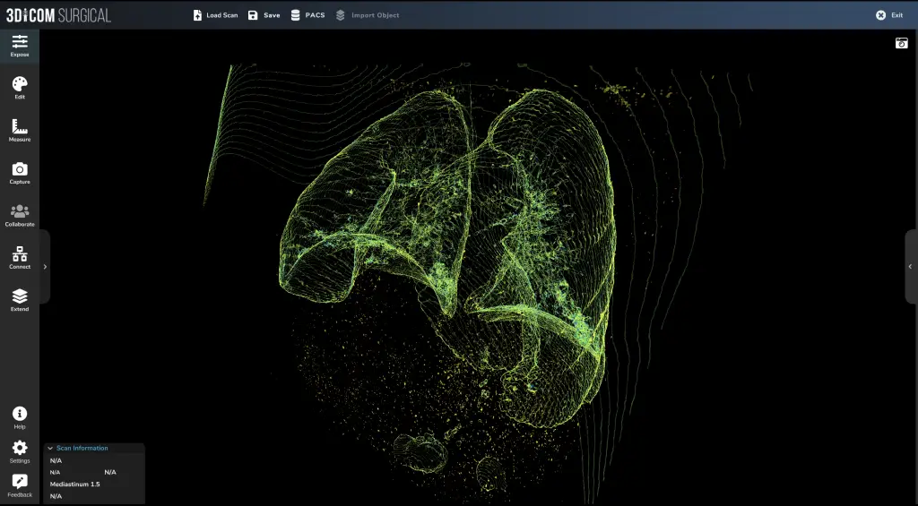 Vista wireframe in 3D di un polmone infetto da COVID