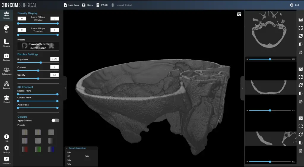 Skull base and foraminal anatomy in 3D