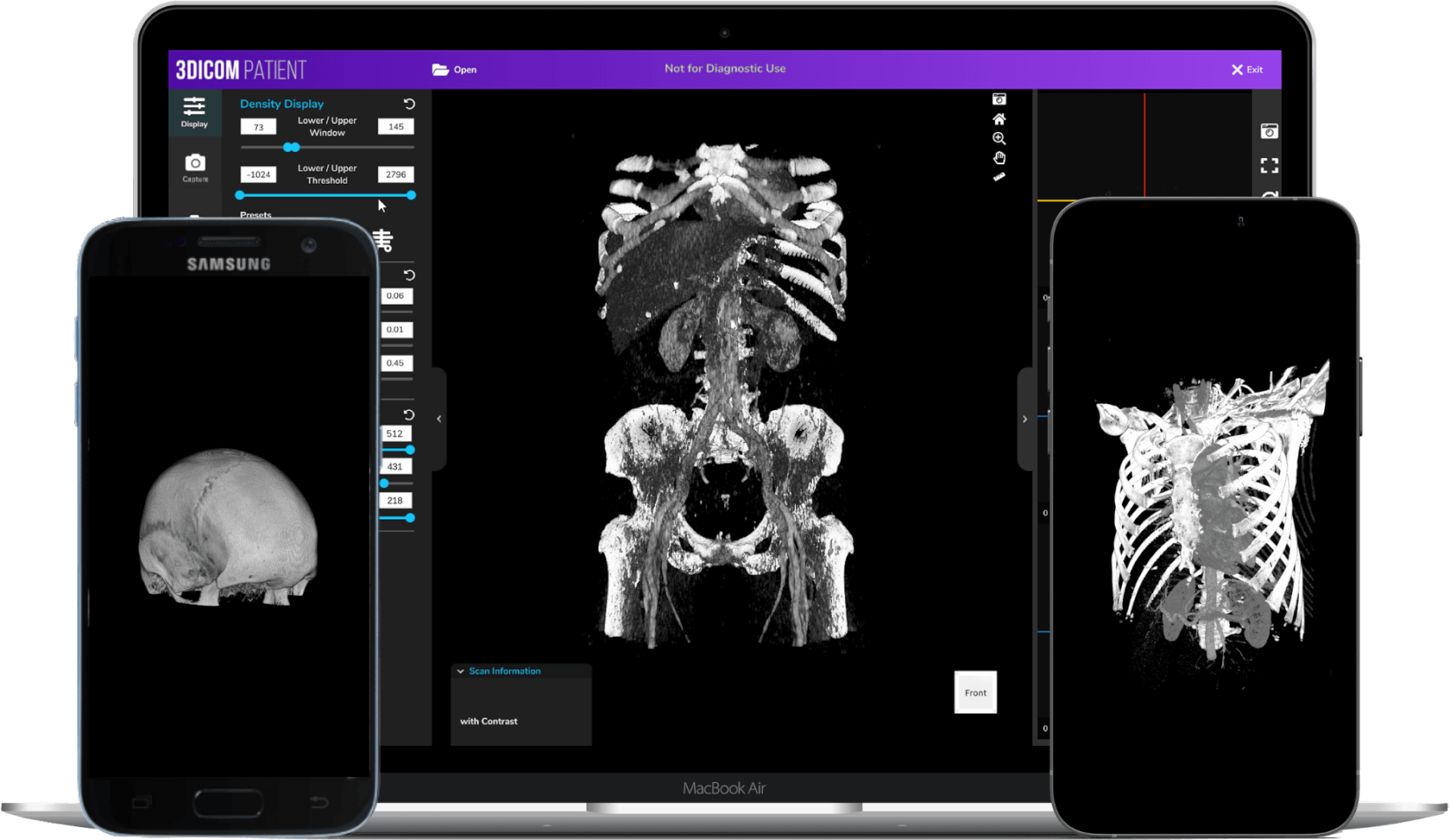 3Dicom Patient – Plattformübergreifender DICOM-Viewer für die Patientenaufklärung – Funktionsbild