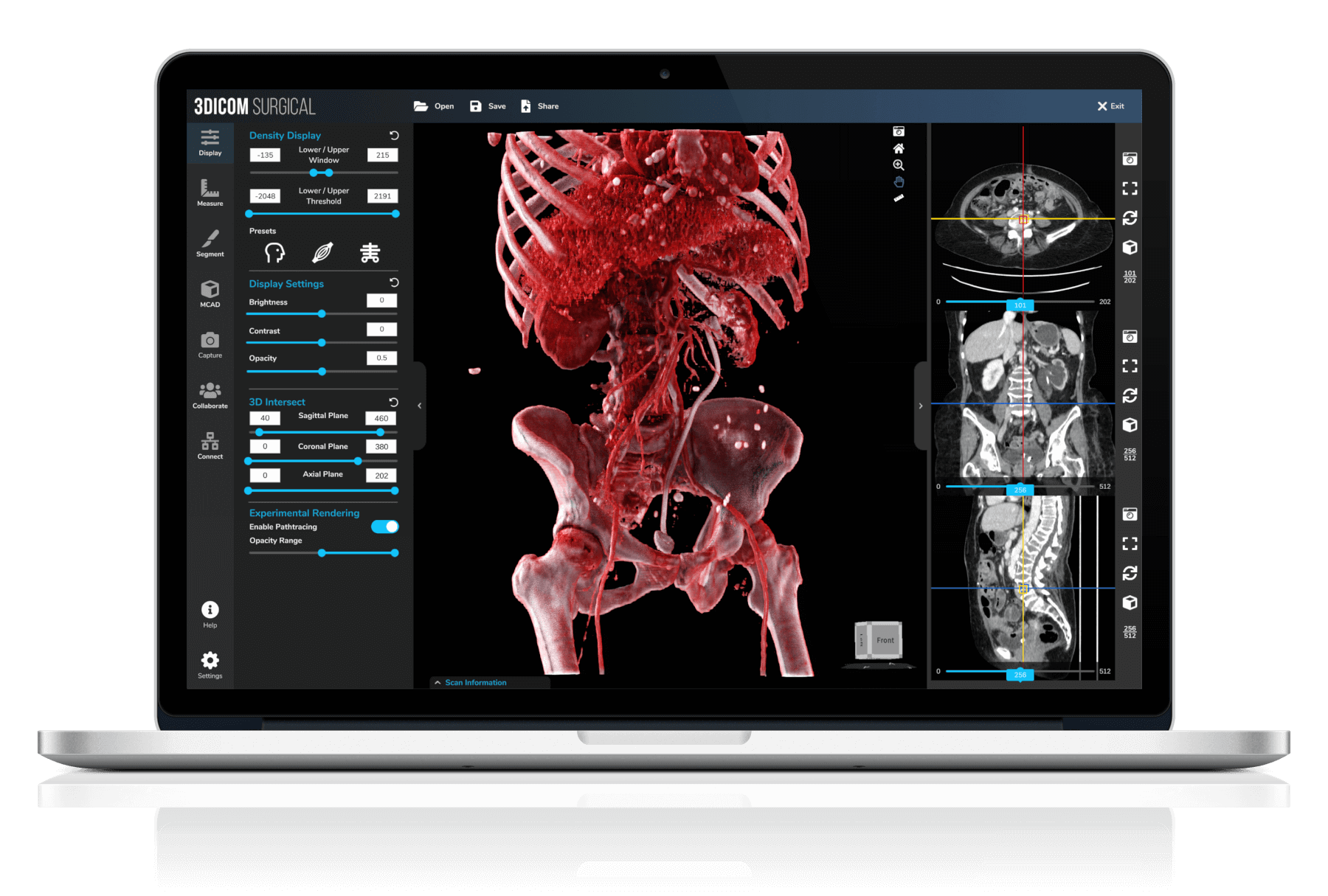 3Dicom Viewer ソフトウェア機能イメージ - 3Dicom Surgical を搭載した MacBook Pro で胸部の画像をカラーで表示