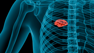 Representasi AI, yang digunakan oleh 3DICOM dan dapat menemukan pertumbuhan yang tidak biasa dalam radiologi dan membantu mendiagnosis pasien.