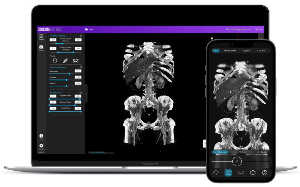 download the last version for ios Sante DICOM Viewer Pro 12.2.8