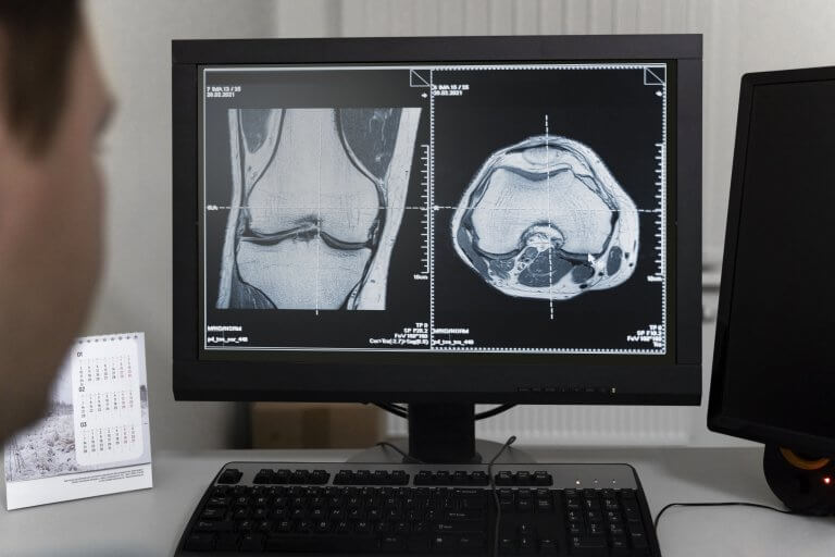 一名醫生正在桌上型電腦上查看患者的 CT 掃描結果。