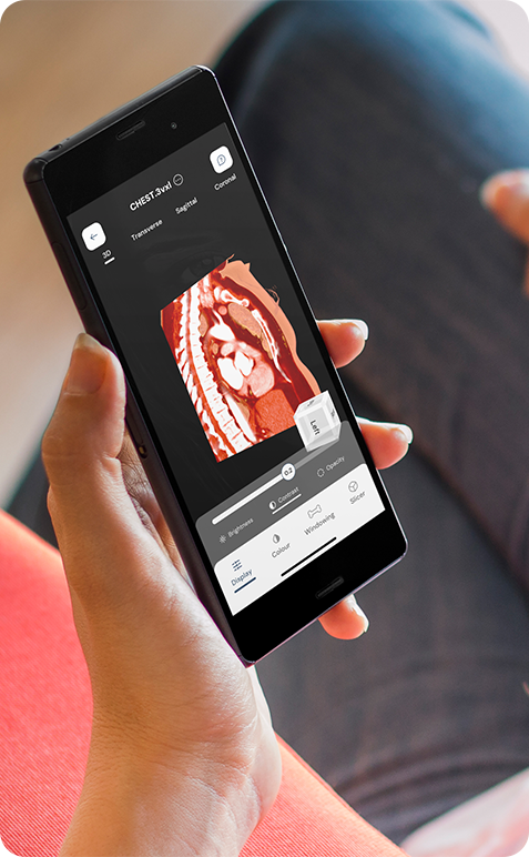 Uma mulher a utilizar a aplicação móvel 3Dicom num androide.