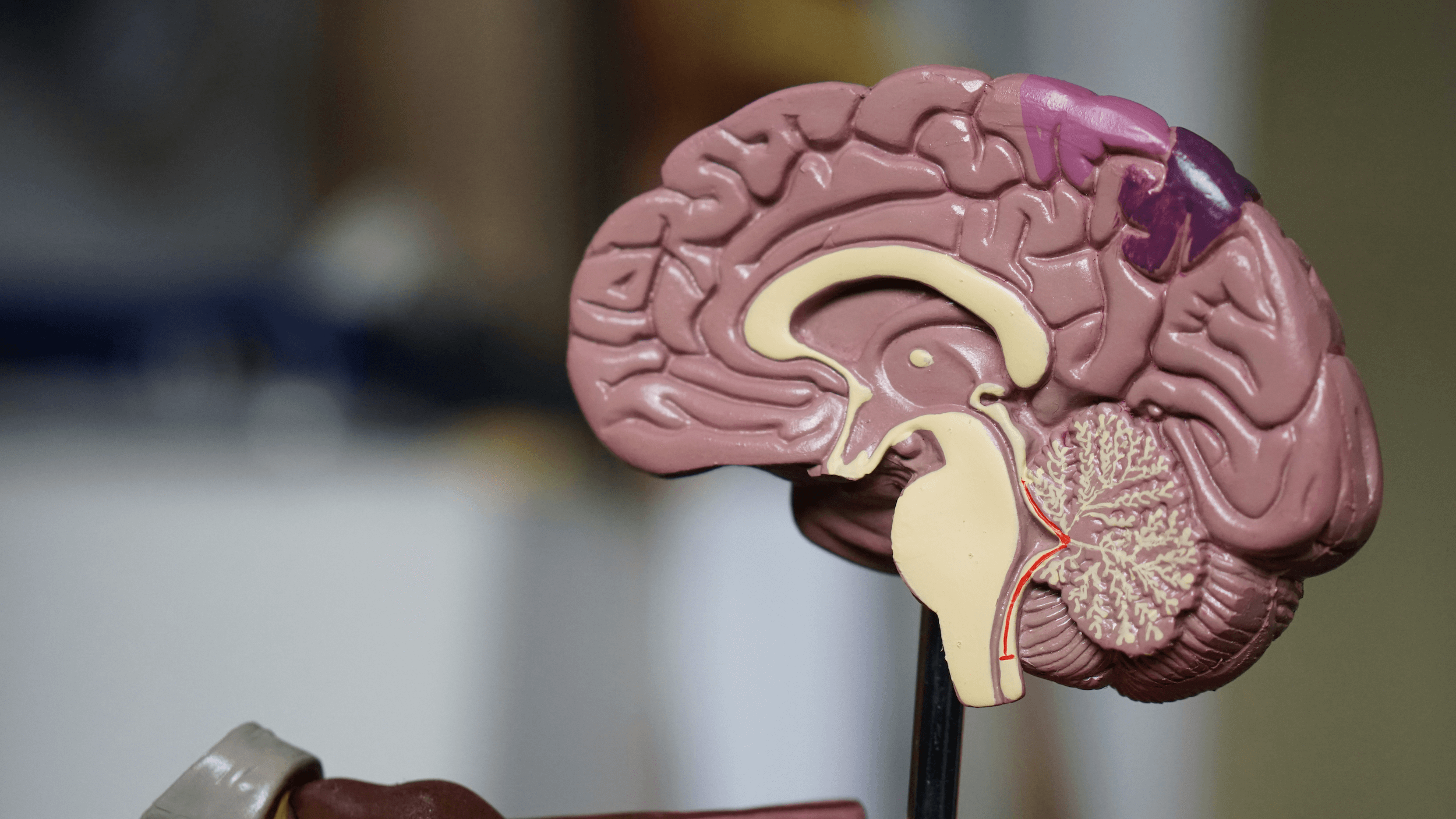 A importância da neuroimagem no diagnóstico de distúrbios cerebrais