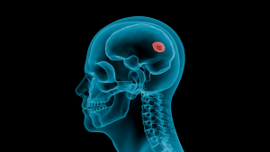 Representasi pemindaian 3D foramen kranial.