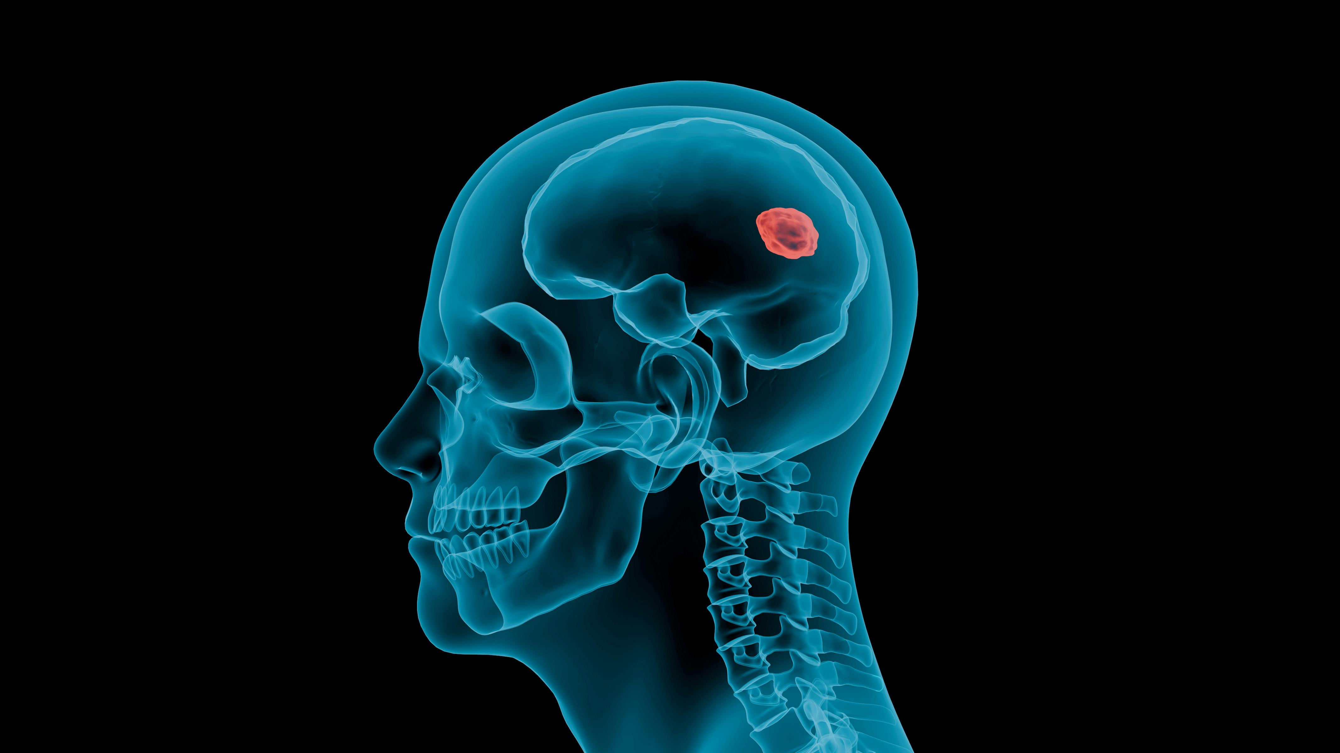 Uma representação de escaneamento 3D dos forames cranianos.