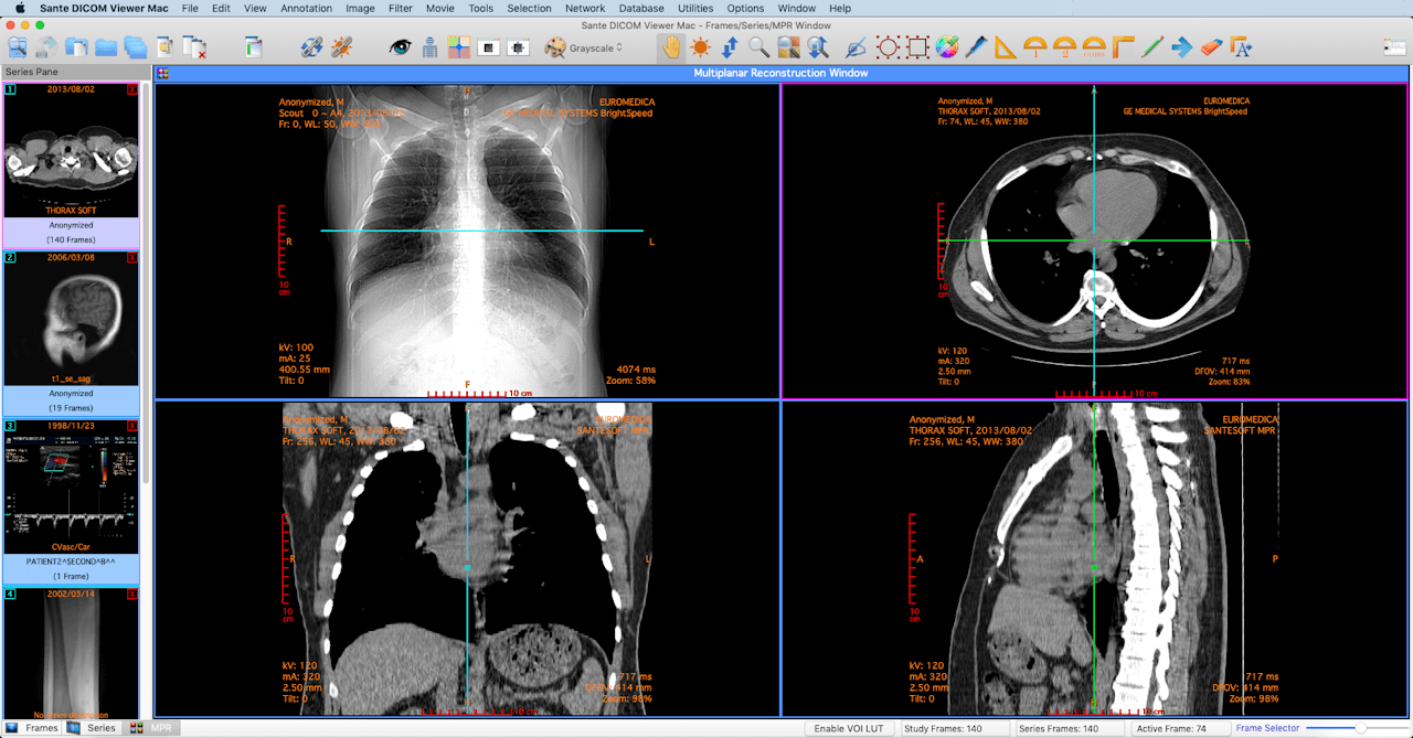 ortho mpr