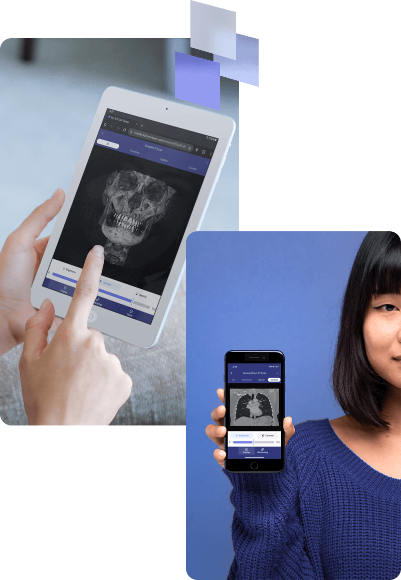 Immagine di una persona che utilizza 3DICOM Mobile su un tablet e immagine di una donna che tiene in mano il suo telefono cellulare e mostra una scansione aperta su 3DICOM Mobile.