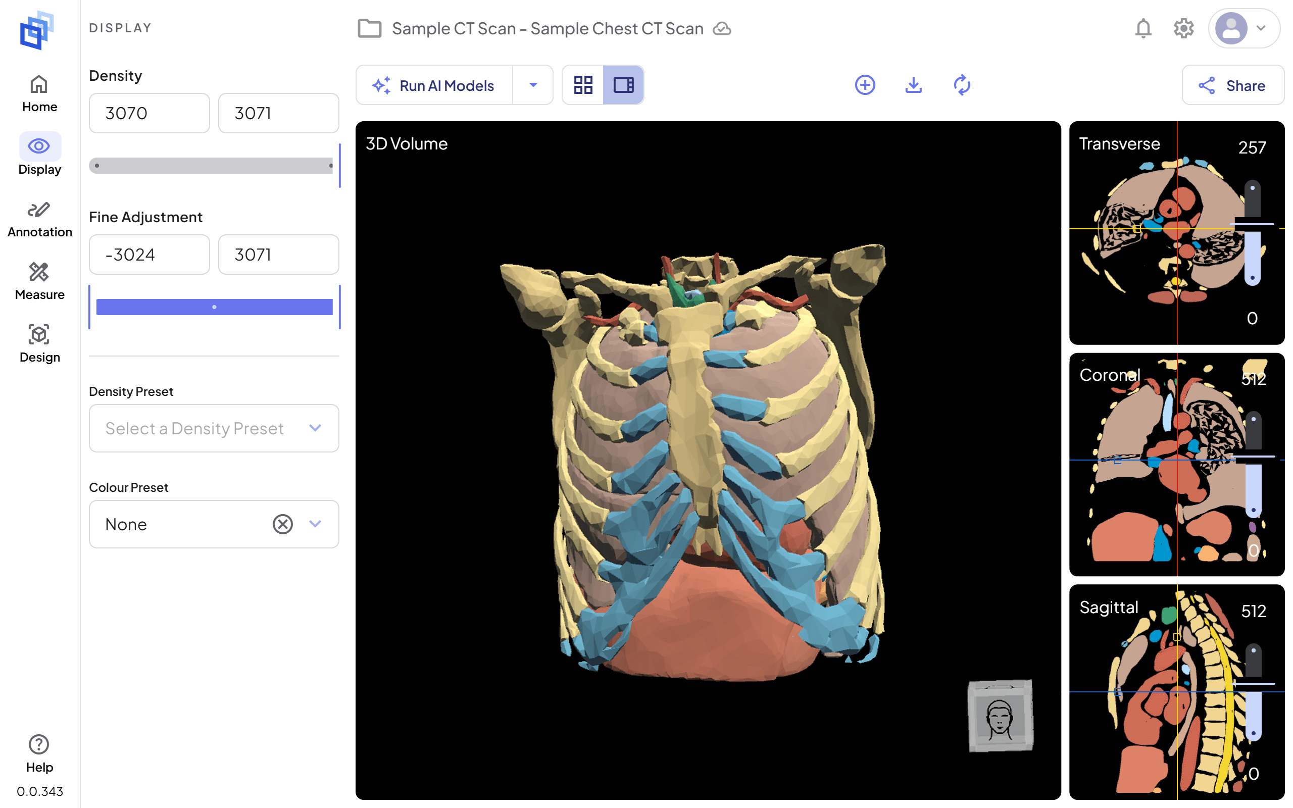 Una scansione del torace aperta nel 3DICOM Online Viewer in cui sono stati applicati Total Segmentator e Auto Annotation.